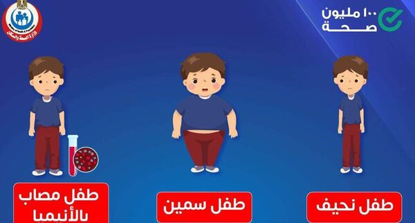 الصحة تحذر من سوء تغذية الأطفال..