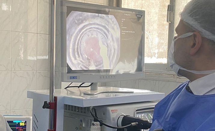 إجراء منظار معدة لأول مرة بمستشفى بلبيس المركزي بعد تشغيل وحدة الأطفال الجديدة