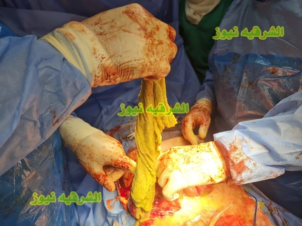 صلاح سالم تنقذ مريض بالصدفه بعد عام ونصف من أجرائه عمليه وترك فوطه بداخله بمستشفي مشهور بالزقازيق