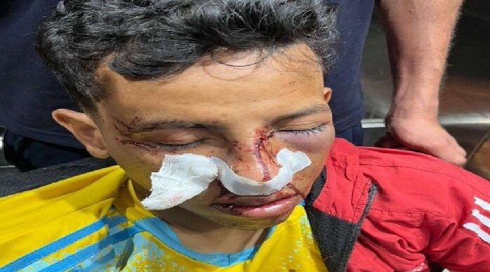 إصابة لاعب كرة بكسر في الأنف إثر تعدي 4 أشخاص عليه داخل ملعب السواقي بمركز أبوكبير